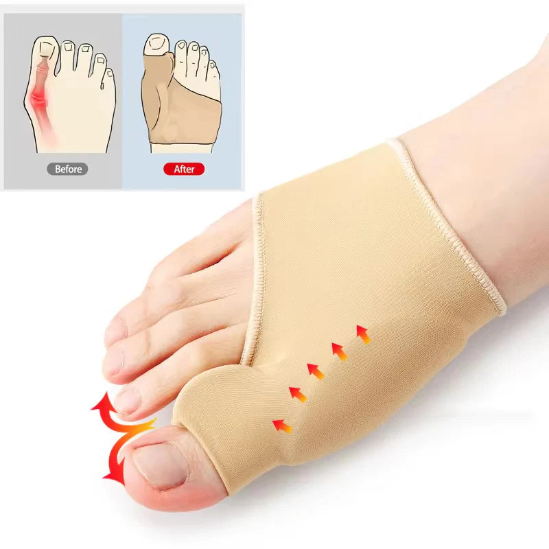 Corrector de Juanete de Silicona – Hallux Valgus Ortopédico