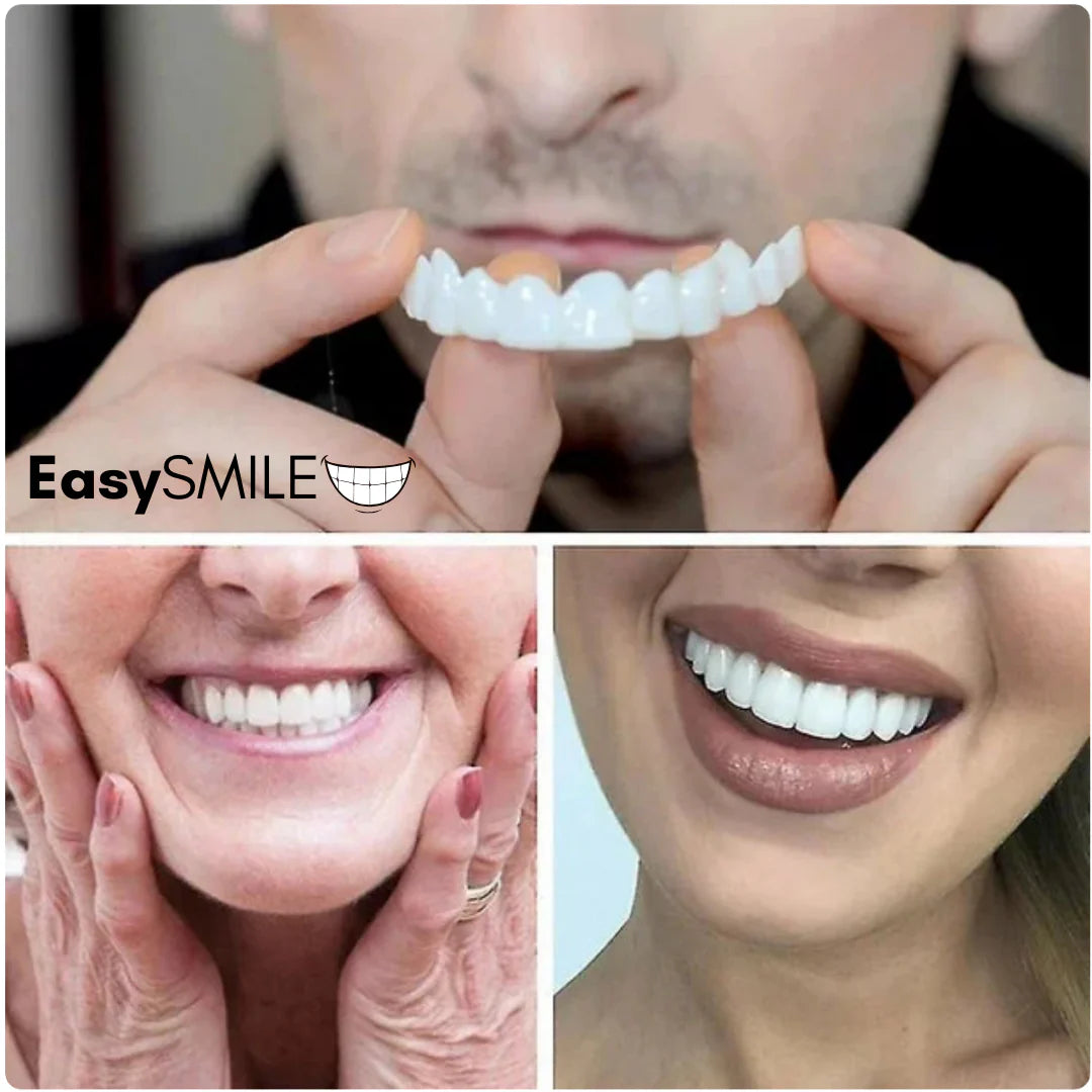EasySmile | Carillas dentales cerámicas adaptables (juego superior e inferior)