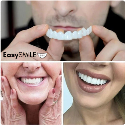 EasySmile | Carillas dentales cerámicas adaptables (juego superior e inferior)