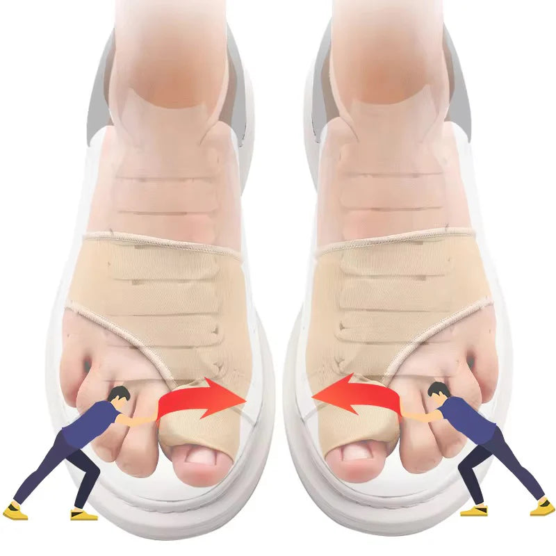 Corrector de Juanete de Silicona – Hallux Valgus Ortopédico