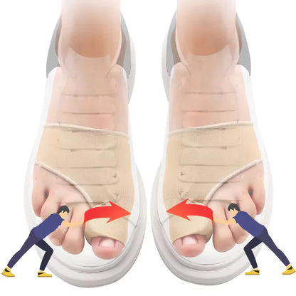 Corrector de Juanete de Silicona – Hallux Valgus Ortopédico
