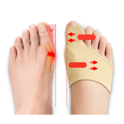 Corrector de Juanete de Silicona – Hallux Valgus Ortopédico