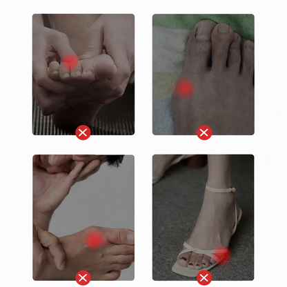 Corrector de Juanete de Silicona – Hallux Valgus Ortopédico