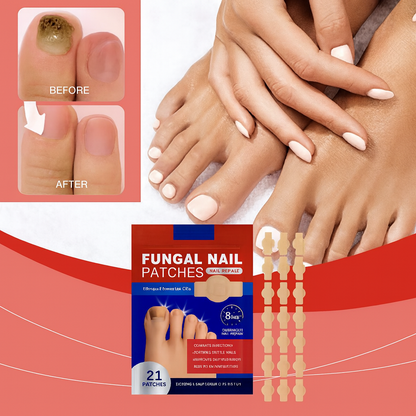 Adhesivo reparador de uñas – Tratamiento antifúngico avanzado