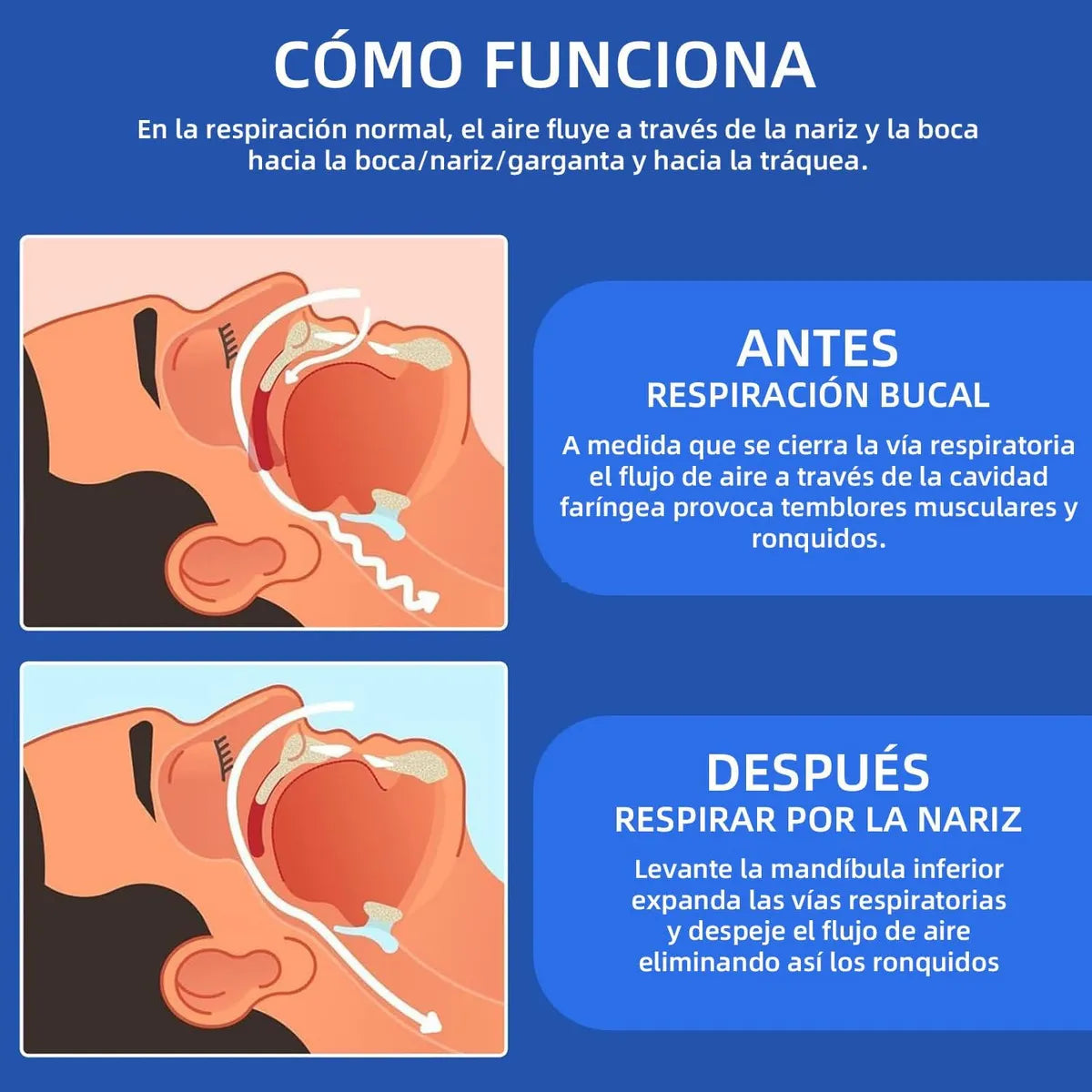 Boquilla Anti-Ronquidos - EstraLuxe SleepQuiet™